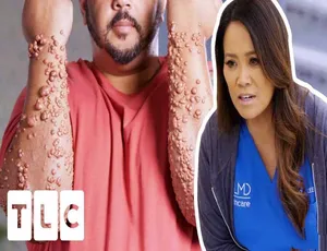 《挤痘大师 Dr Pimple Popper 第九季：1080P 全 10 集中字纪录片解说素材 [21.4G 百度网盘]》
