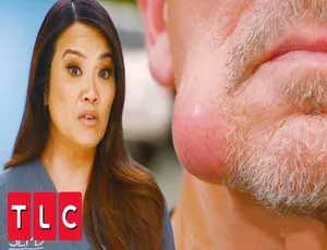 《挤痘大师 Dr. Pimple Popper 第 7-8 季：1080P 中字完整版 40.88G 百度网盘资源》-小文资源网