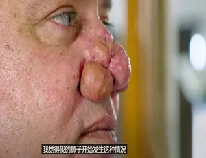 1080P中字第1季！纪录片《肿瘤医生》百度网盘资源-小文资源网