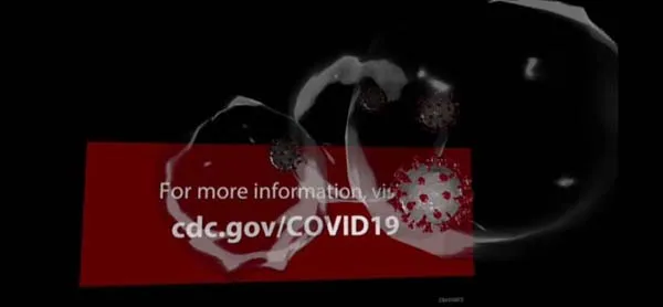 VR游戏《病毒VR COVID-19 Virus v0.1》[英文][159.08MB][百度网盘]