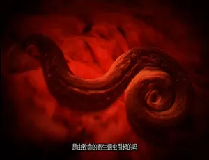 1080P 英语中字！《体内的怪物/病魔缠身》纪录片第三季 10 集 百度网盘资源-小文资源网