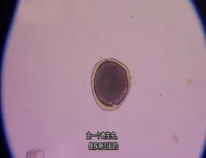 1080P 英语中字！纪录片《体内的怪物/病魔缠身》第一季 6 集 百度网盘资源-小文资源网
