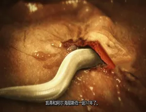 1000P 英语中字！纪录片《体内的怪物/病魔缠身》第八季12集 网盘资源-小文资源网